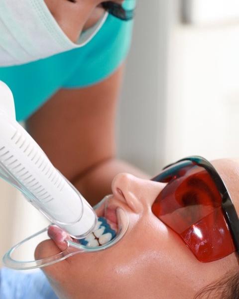 Professional laser teeth whitening device activating bleaching gel