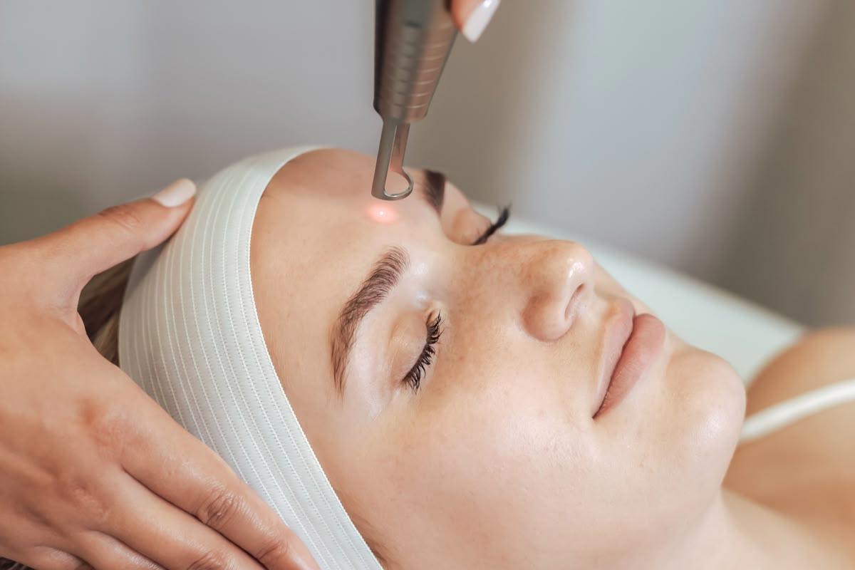 Close-up of face during IPL therapy session