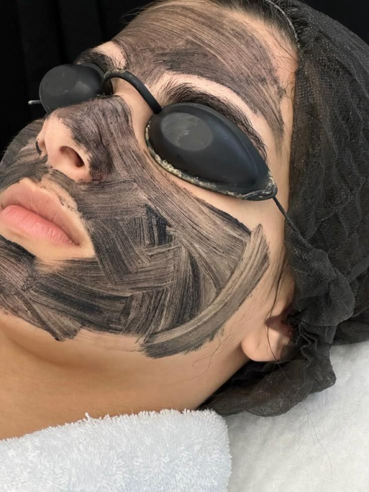 Close-up of face during IPL therapy session