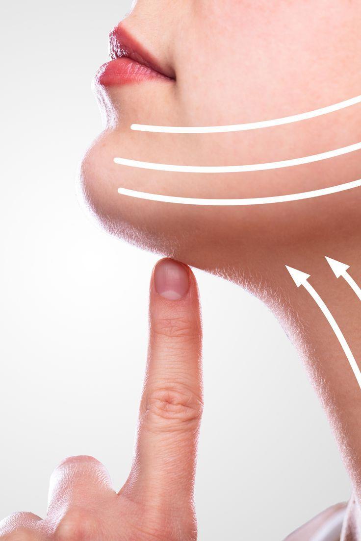 Dermal filler treatment to smooth facial wrinkles