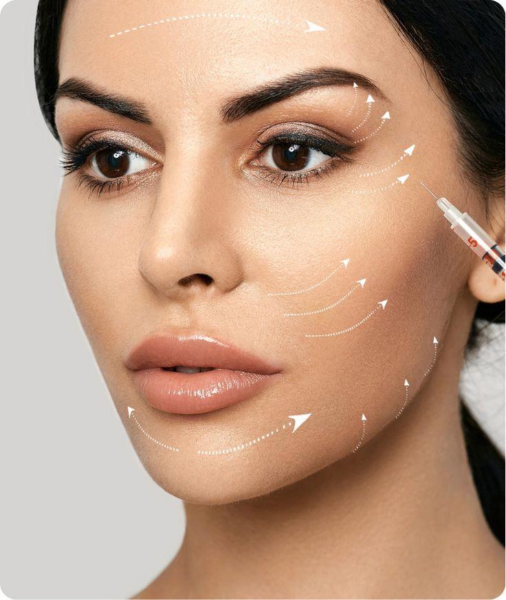 Anti-wrinkle injections for crow’s feet in Scotter